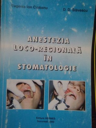 Anestezia locoregionala in stomatologie