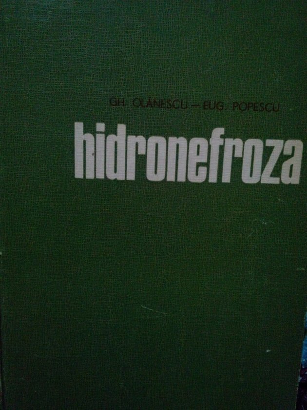 Hidronefroza