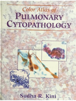 Color Atlas of pulmonary cytopathology