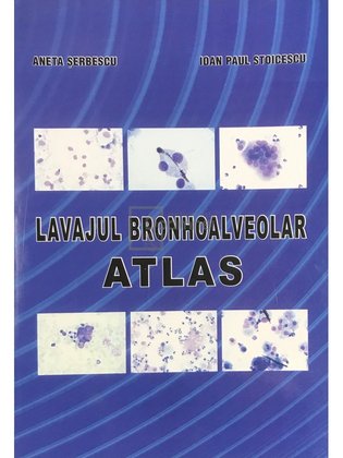 Lavajul bronhoalveolar - Atlas